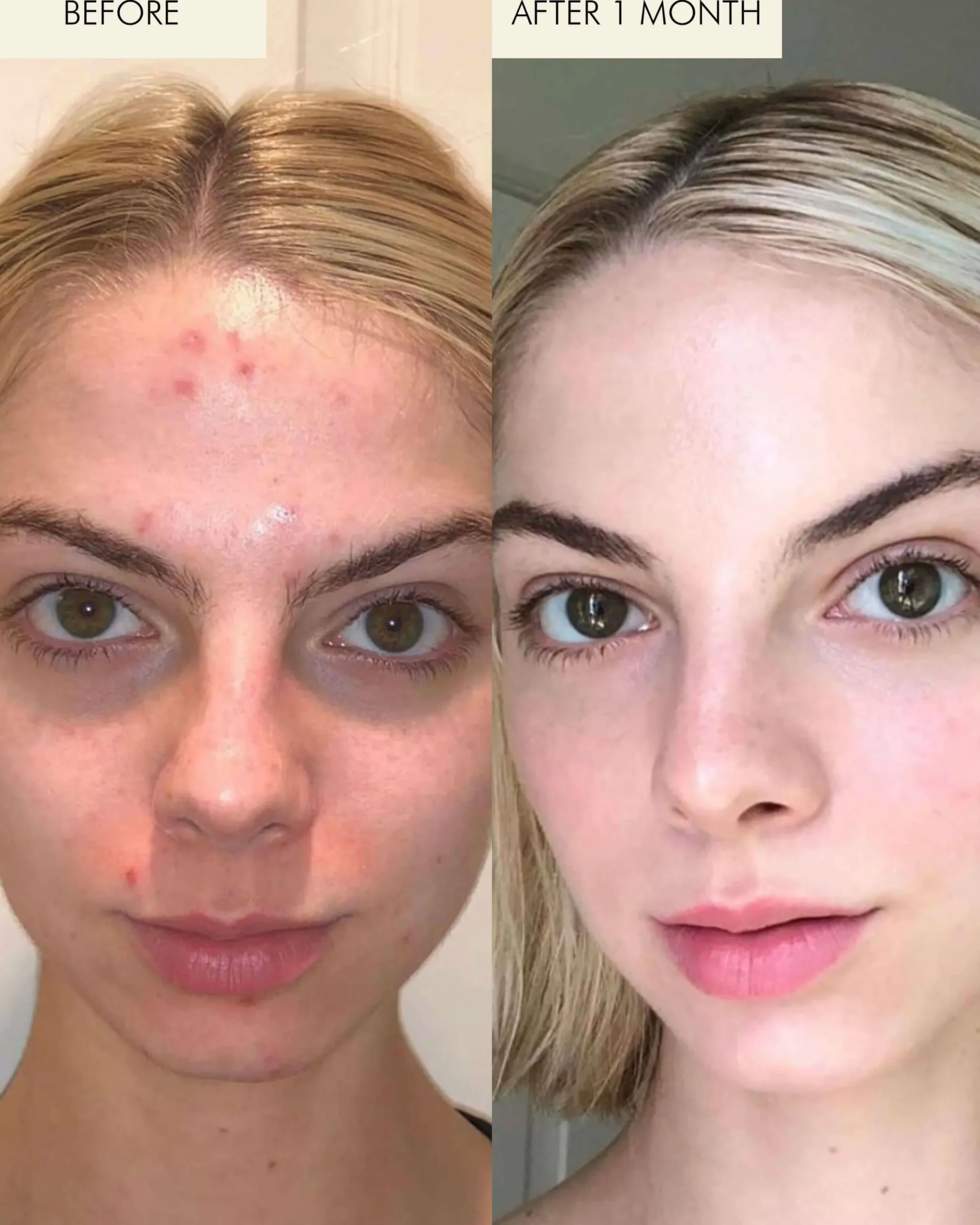1.2% Clean Algae Retinol Face Oil for Anti-Aging and Wrinkles with Green Tea