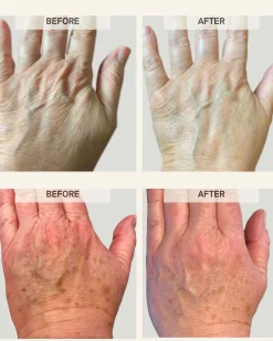 Activating Hand Serum