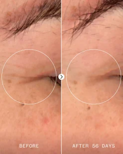 Age Confidence NAD+ & Tri-peptide Serum