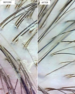 Arey Scalp Renewal Duo