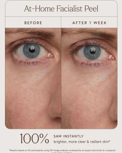At-Home Facialist Peel