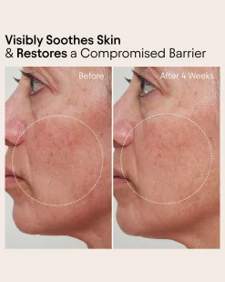 Barrier Repair Cream Moisturizer for Eczema, Barrier and Wrinkle Repair