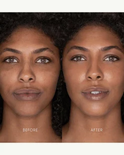 Best Skin Days Treatment Concealer