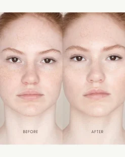 Best Skin Days Treatment Concealer