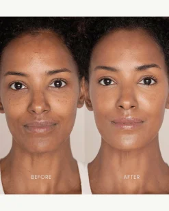 Best Skin Days Treatment Concealer