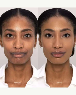 Best Skin Days Treatment Concealer