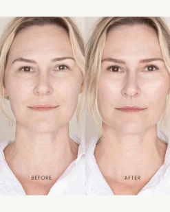 Best Skin Days Treatment Concealer