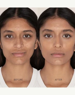 Best Skin Days Treatment Concealer