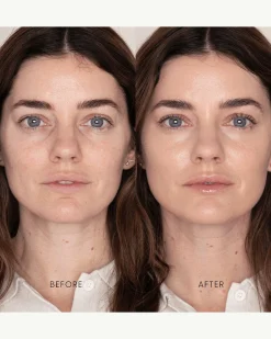 Best Skin Days Treatment Concealer