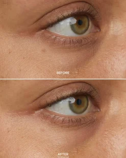 Chebula Multi-Corrective Eye Patches