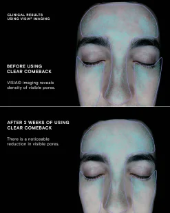 Clear Comeback Probiotic Enzyme Powder Refill