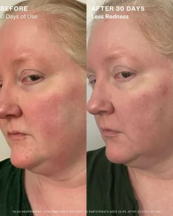 Clear Skin Mineral Milk 2% Salicylic Acid Acne Treatment with Niacinamide + Copper