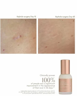 Complex Scar Serum