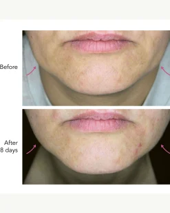 DNA-42 Clinicalift Serum