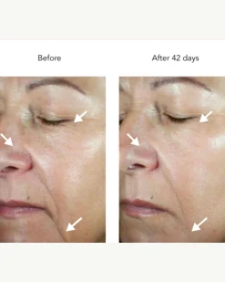DNA-42 Clinicalift Serum