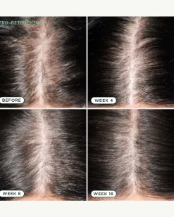 DNA Scalp Serum