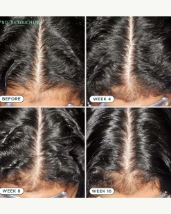 DNA Scalp Serum