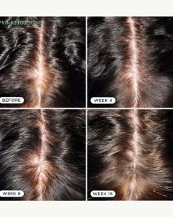 DNA Scalp Serum