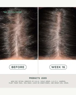 DNA Scalp Serum