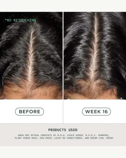 DNA Scalp Serum