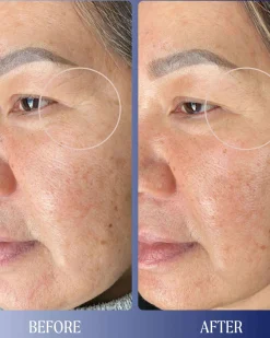 Dreamwave 2% Bio-Retinoid Complex Overnight Serum