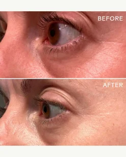 EyeHero™ Bio-Retinol Smoothing Eye Cream