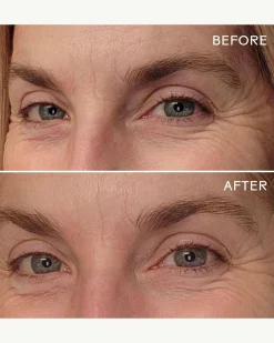 EyeHero™ Bio-Retinol Smoothing Eye Cream