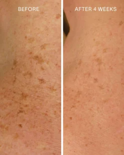 Glycolic + Bakuchiol Smoothing Body Treatment