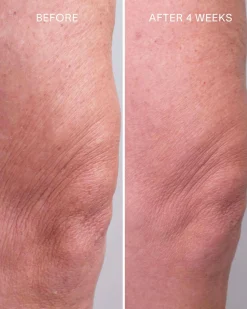 Glycolic + Bakuchiol Smoothing Body Treatment