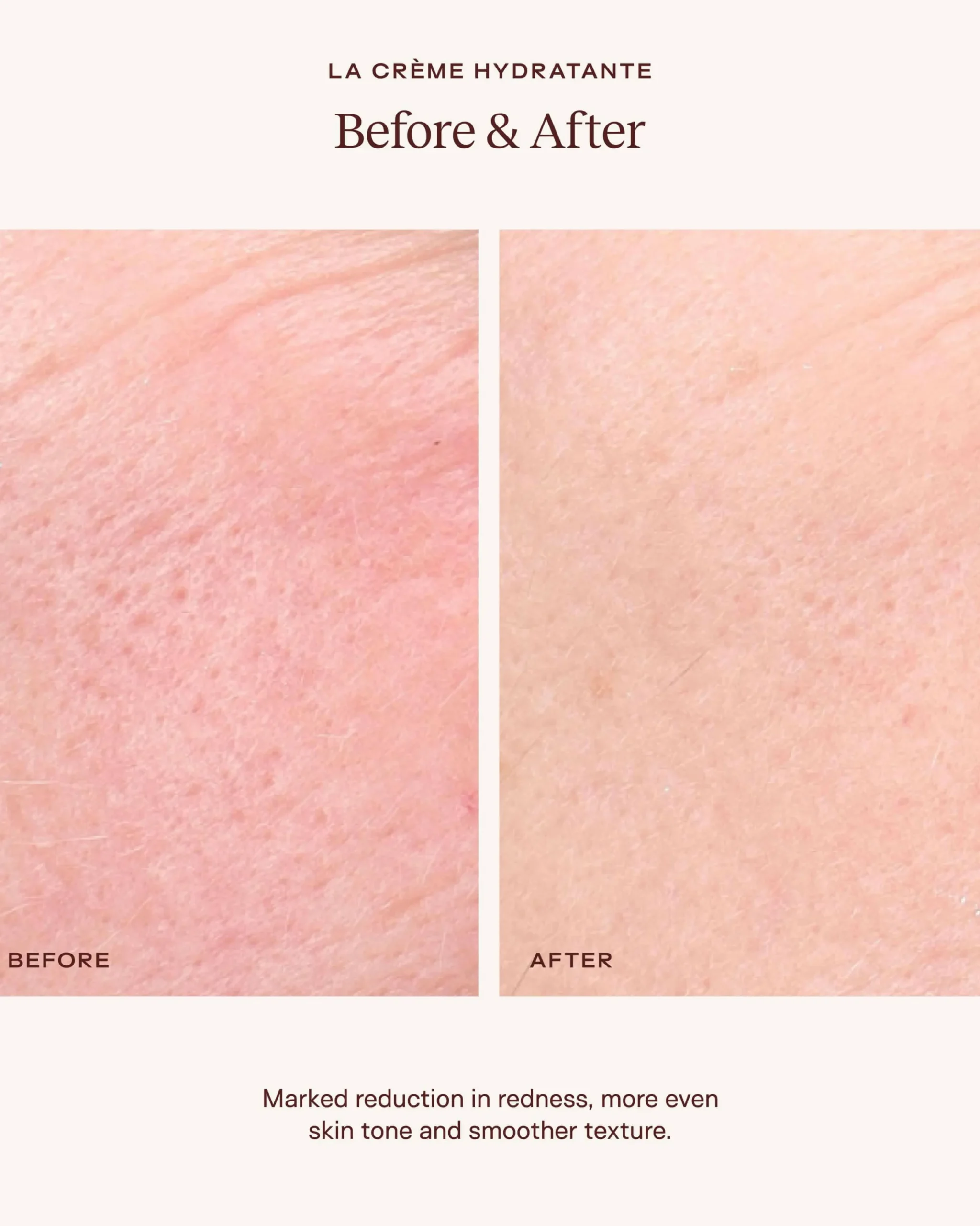 La Crème Hydratante – Beta-Glucan Mushroom Moisturizer