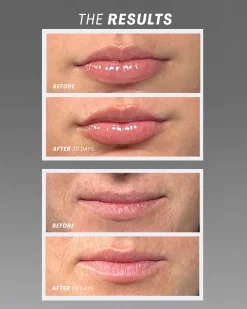Lip Oasis™️ Glossy Treatment