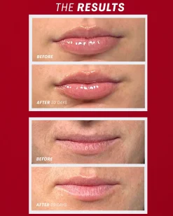 Lip Oasis™️ Glossy Treatment