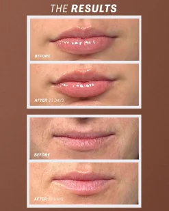 Lip Oasis™️ Glossy Treatment