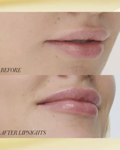 Lipnights Overnight Lip Mask