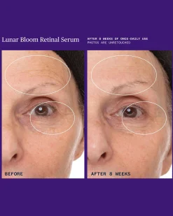 Lunar Bloom Retinol Serum for Fine Lines, Wrinkles & Uneven Skin Tone