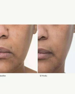 Plumscreen SPF 31
