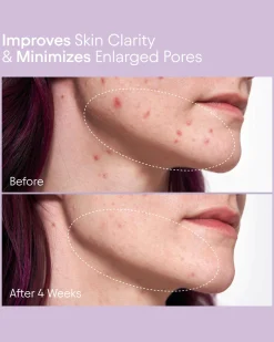 Pore Perfecting Liquid with 2% BHA + Borage