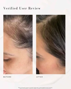 Power Fol Multi-Correctional Scalp and Hair Treatment