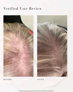 Power Fol Multi-Correctional Scalp and Hair Treatment