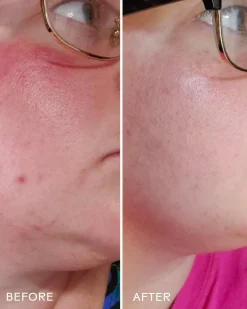 Radiance Grape Stem Cell + Squalane Day Cream