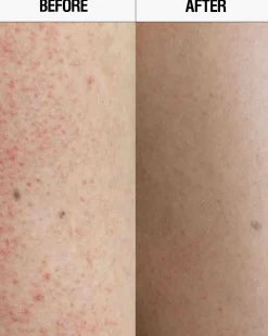Resurfacing Targeted Body Cleanser