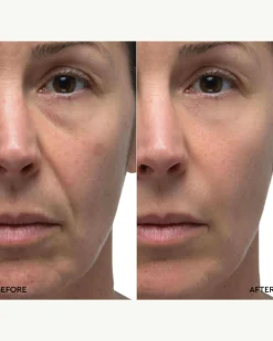 Retinol Rescue Overnight Cream