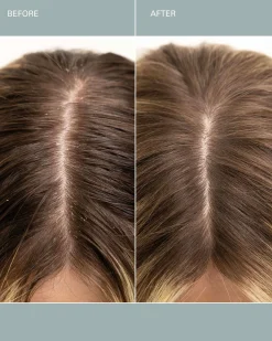 Salt Scalp Scrub