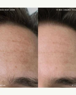 Skin Reset Serum Refill