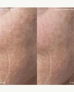 Skin Reset Serum Refill
