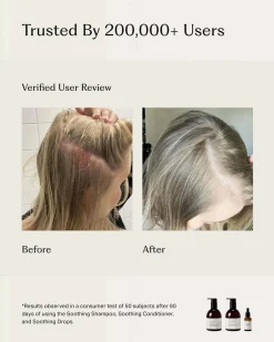 Soothing Scalp Treatment Drops