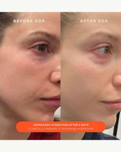 SOS Daily Barrier Recovery Cream