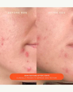 SOS Daily Barrier Recovery Cream