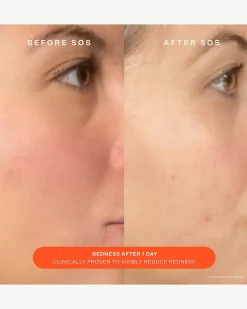 SOS Daily Barrier Recovery Cream