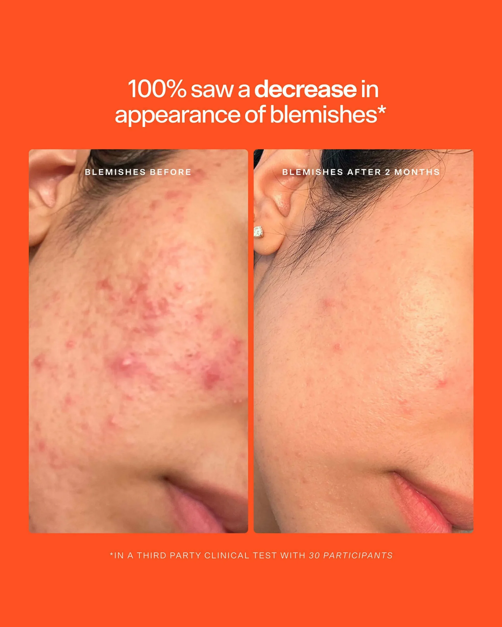 SOS Daily Rescue Spray Duo